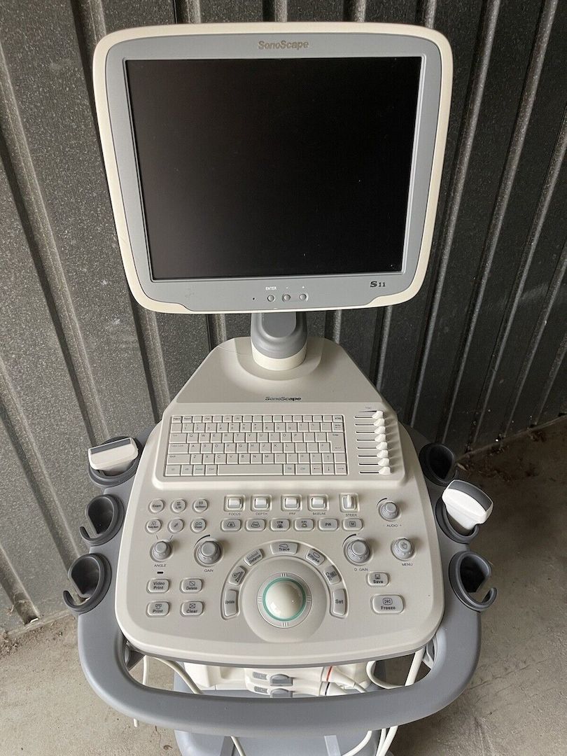 SonoScape S11 Farbdoppler Ultraschallsystem
