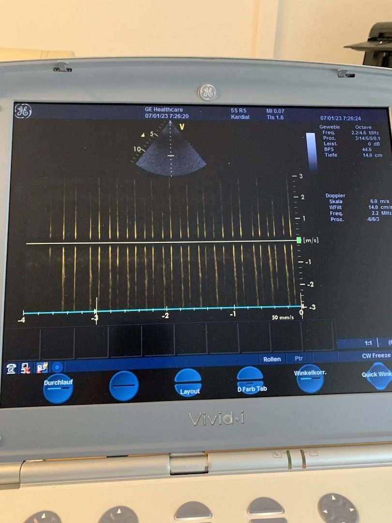 GE VIVID i Mit 5S-RS Kardiologische Sektorsonde. Neuer Akku . Netzteil