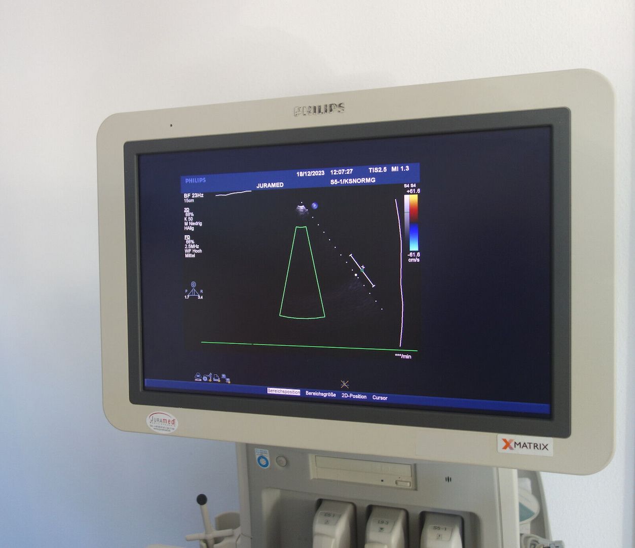 Farbdoppler Philips iE33 Ultraschallgerät mit 3 Sonden und Stiftsonde