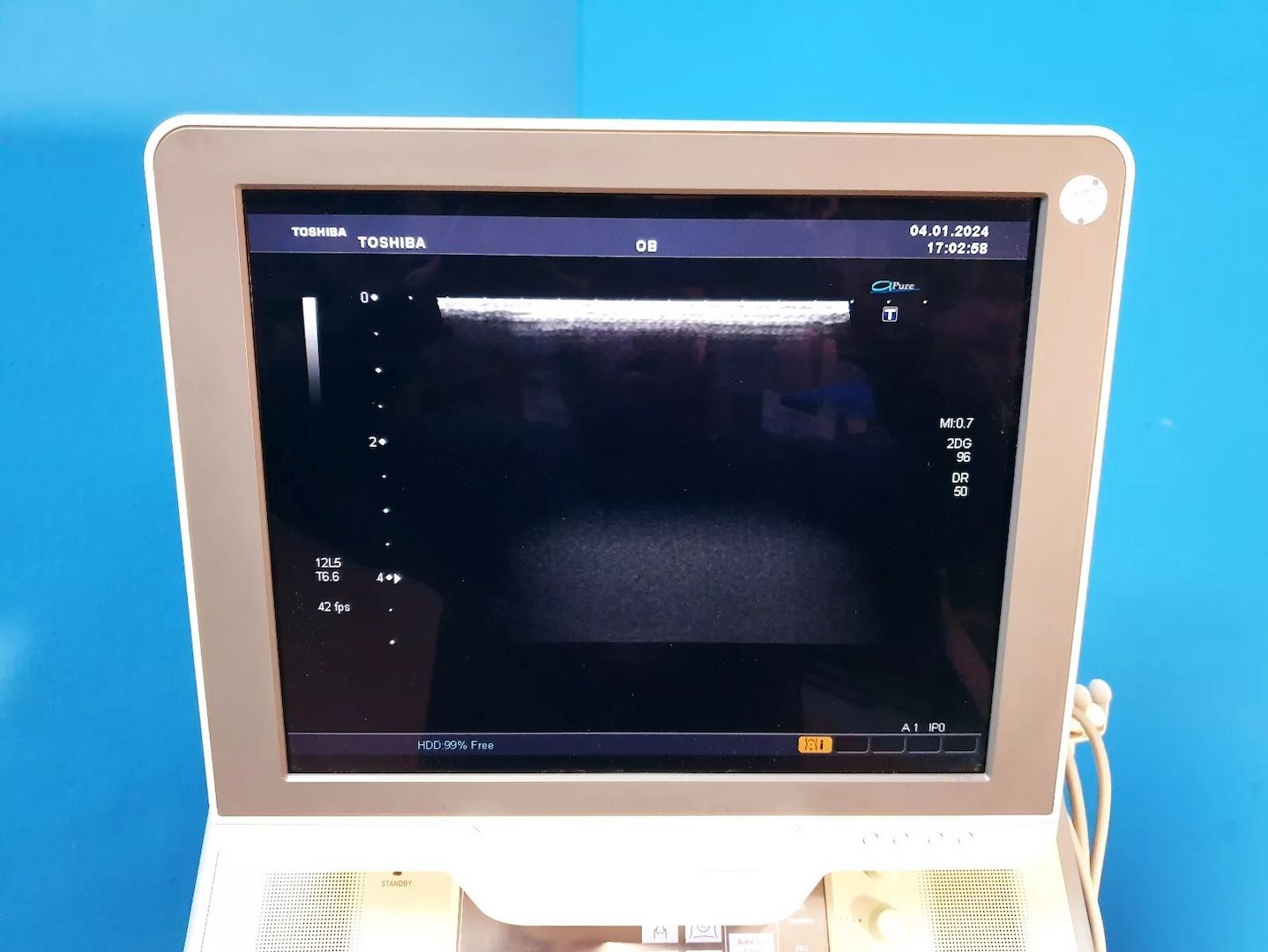 Toshiba Xario SSA-660A Ultraschallgerät