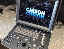 Chison Eco 5 Mobiles Ultraschall Portable Ultrasound