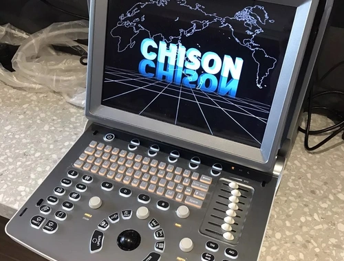 Chison Eco 5 Mobiles Ultraschall Portable Ultrasound