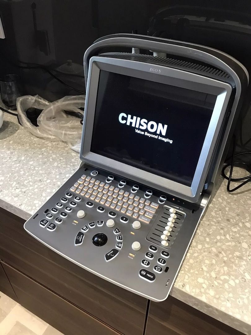 Chison Eco 5 Mobiles Ultraschall Portable Ultrasound