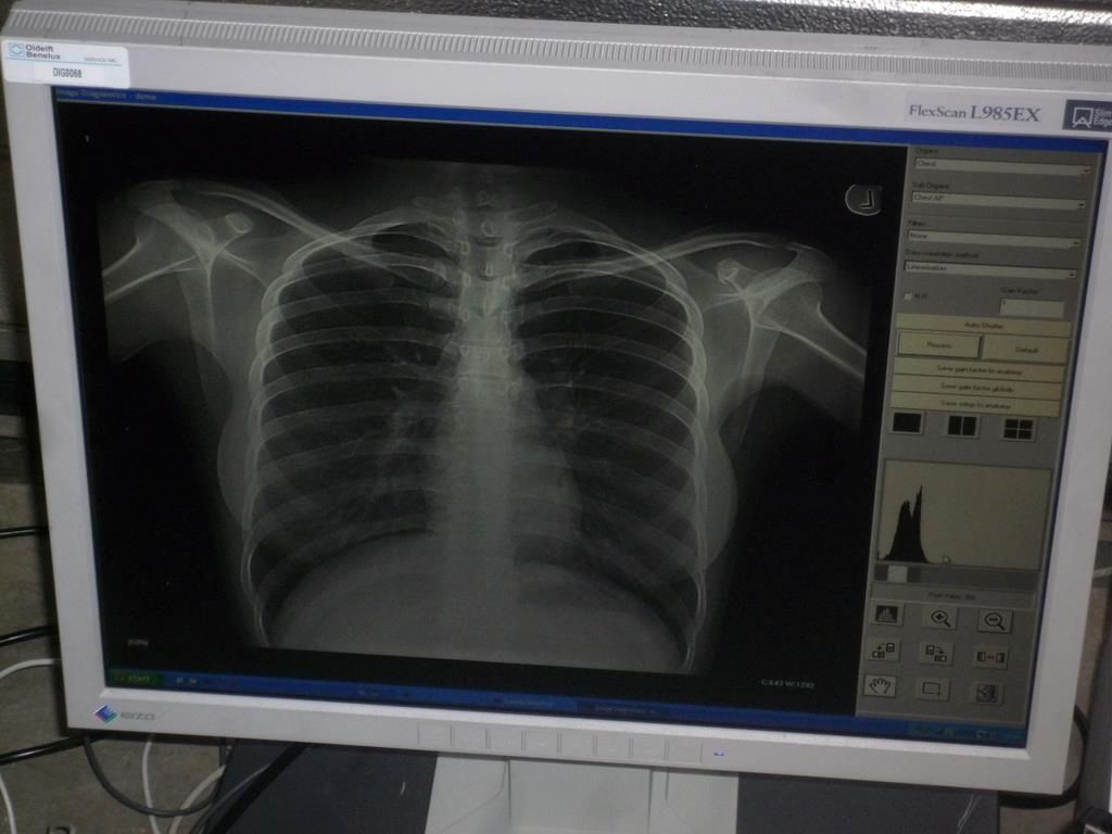 Kodak Orex PcCR 1417 ACL4 Digital X-ray Röntgen Imaging
