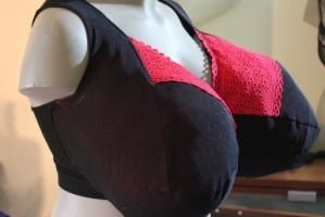 Du hast Riesenwuchs (Makromastie/Gigantomastie)?!