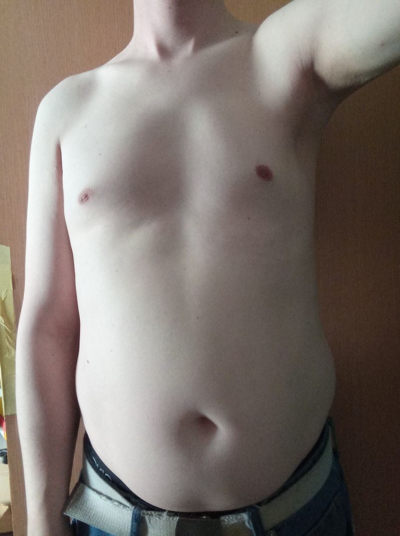 Jeder hat Sex, warum ich nicht?