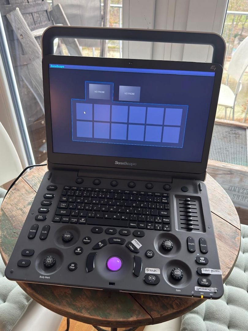 SonoScape E1 Ultraschall  Linearsonde L741