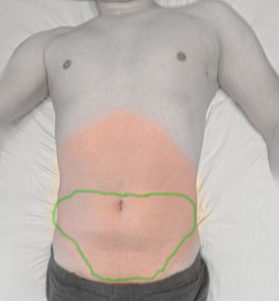 Suche Paare, Frauen oder Männer mit sadistischer Ader die auf mein Bauch rumhüpfen,stampfen,trampeln