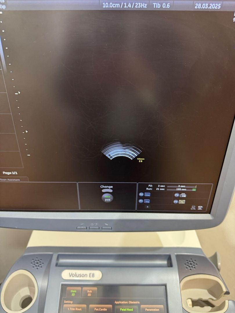 GE Voluson E8 Ultraschallgerät Gynäkologie