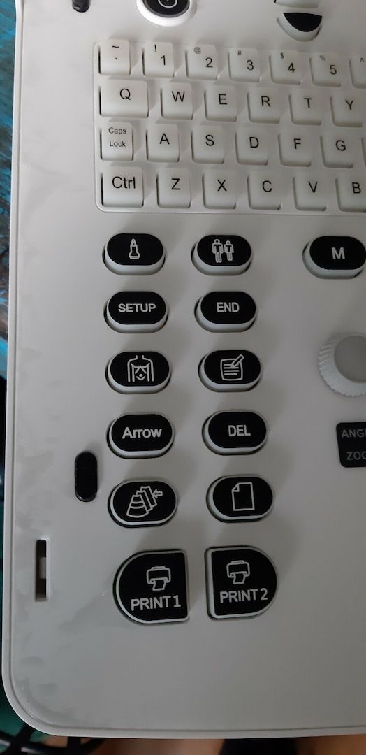 Zimmer Ultraschall-Diagnosesystem Modell SonidoSmart
