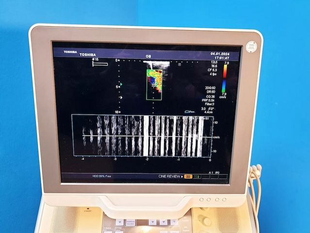 Toshiba Xario SSA-660A Ultraschallgerät