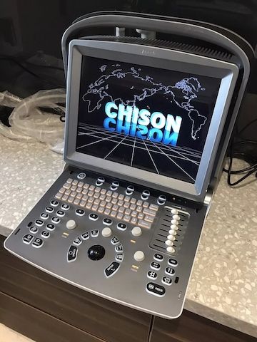 Chison Eco 5 Mobiles Ultraschall Portable Ultrasound