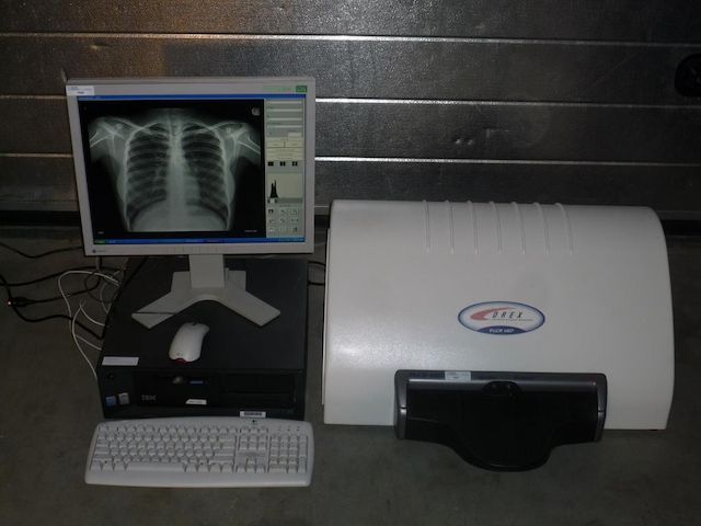 Kodak Orex PcCR 1417 ACL4 Digital X-ray Röntgen Imaging