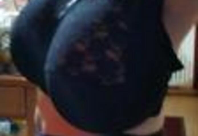 Du hast Riesenwuchs (Makromastie/Gigantomastie)?!