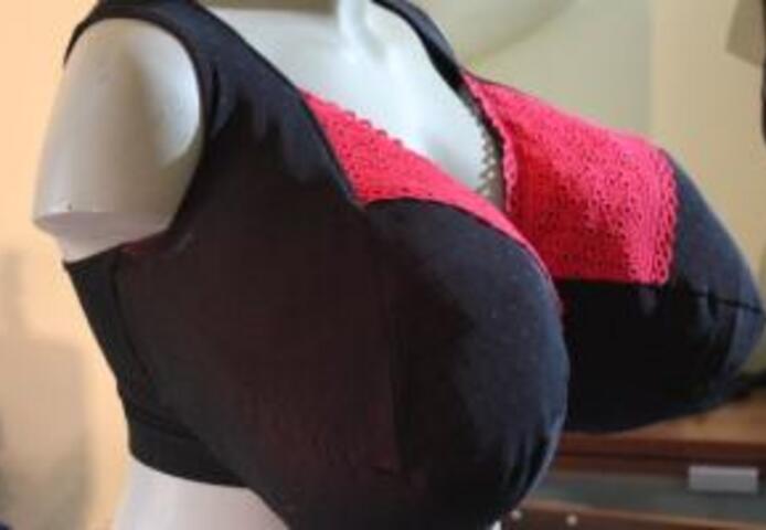 Du hast Riesenwuchs (Makromastie/Gigantomastie)?!